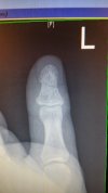 thumb xray.jpg thumb xray.jpg